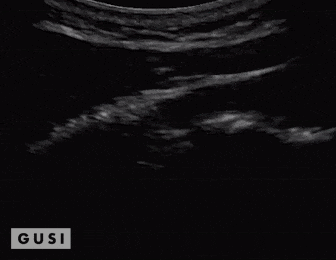 Physician-Led Management and Funding for POCUS | Nov 2023 Newsletter 12 unnamed 1 min