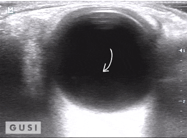 Physician-Led Management and Funding for POCUS | Nov 2023 Newsletter 16 unnamed 2 min