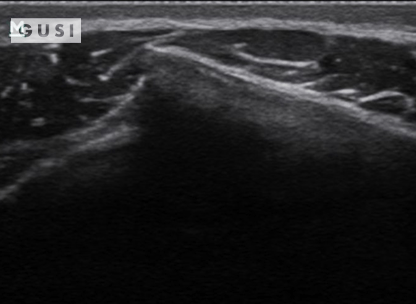 Physician-Led Management and Funding for POCUS | Nov 2023 Newsletter 4 unnamed 2 min