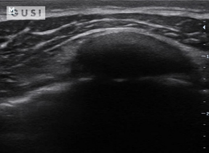 Physician-Led Management and Funding for POCUS | Nov 2023 Newsletter 5 unnamed 3 min