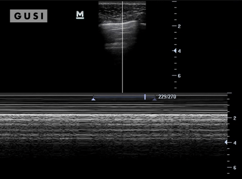 Physician-Led Management and Funding for POCUS | Nov 2023 Newsletter 6 unnamed 4 min