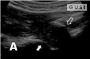 Physician-Led Management and Funding for POCUS | Nov 2023 Newsletter 9 unnamed 5 min