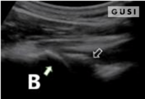Physician-Led Management and Funding for POCUS | Nov 2023 Newsletter 10 unnamed 6 min
