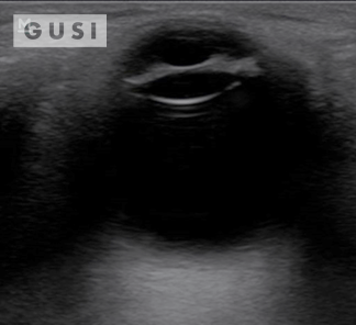 Physician-Led Management and Funding for POCUS | Nov 2023 Newsletter 14 unnamed 7 min