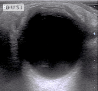 Physician-Led Management and Funding for POCUS | Nov 2023 Newsletter 15 unnamed 8 min