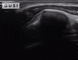 Physician-Led Management and Funding for POCUS | Nov 2023 Newsletter 7 unnamed min