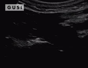 Physician-Led Management and Funding for POCUS | Nov 2023 Newsletter 11 unnamed min