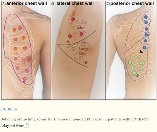 Navigating Cold and Flu Season: The Power of POCUS in Respiratory Diagnosis | Dec 2023 Newsletter 6 unnamed 30