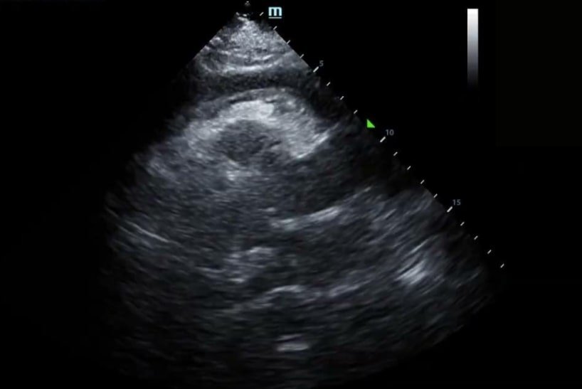 Navigating Cold and Flu Season: The Power of POCUS in Respiratory Diagnosis | Dec 2023 Newsletter 9 unnamed 33