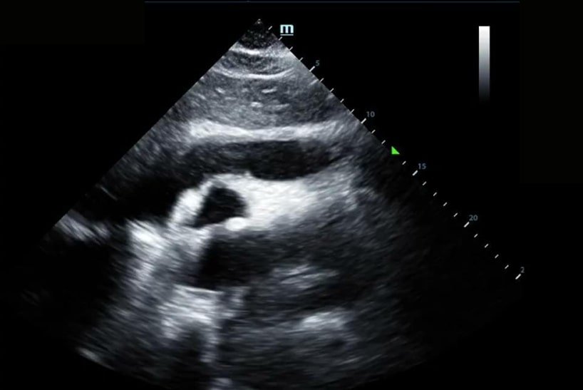 Navigating Cold and Flu Season: The Power of POCUS in Respiratory Diagnosis | Dec 2023 Newsletter 10 unnamed 34