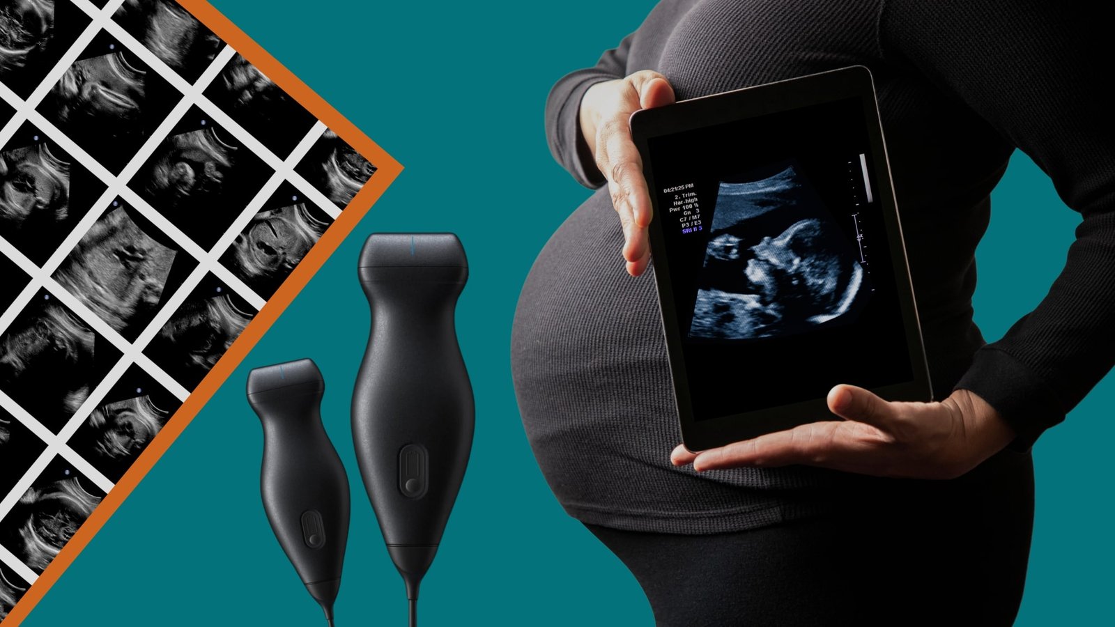 The Future of Medical Education: Integrating POCUS into Undergraduate Programs 3 GUSI Global Ultrasound Institute POCUS Undergraduate Progams Image 2 2048x1152 1